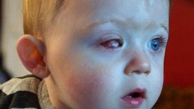 dron niño kid child eye ojo accidente dron juguete inglaterra birmingham noticia 18 meses tuerto sin ojo helice
